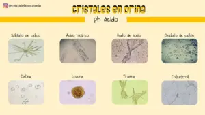 El significado del oxalato en las piedras de protección el-significado-del-oxalato-en-las-piedras-de-proteccion