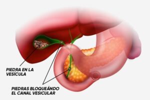 razones-para-evitar-el-contacto-con-las-piedras